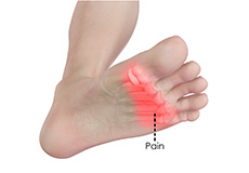 Foot Pain