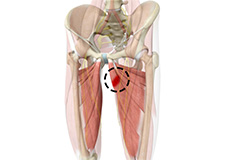 Hip Adductor Injuries