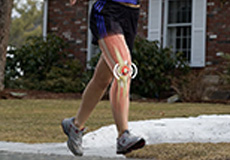 Runner's Knee