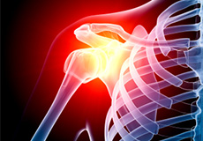 Shoulder Pain